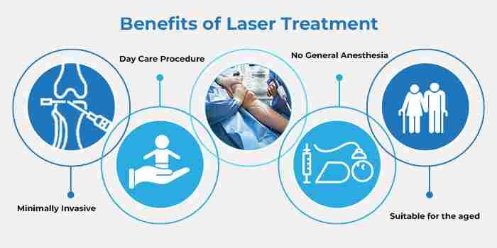 Benefits Of Laser Varicose Veins Procedure